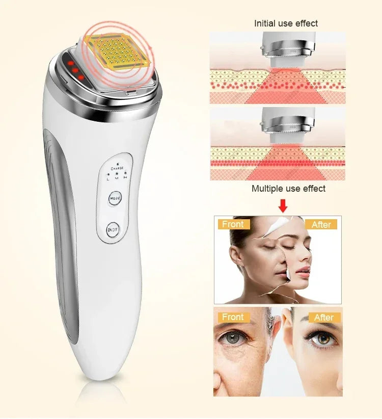 RF Face Lifting Massager